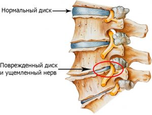 Spine 